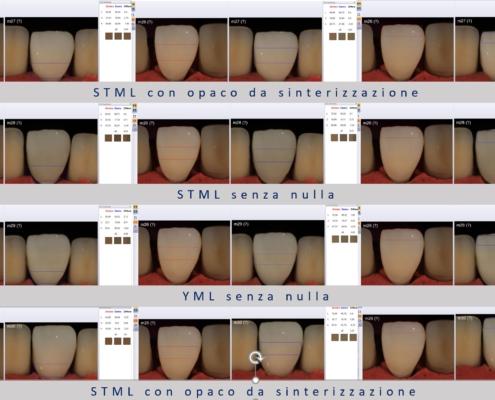 zirconia letture con spectroshade