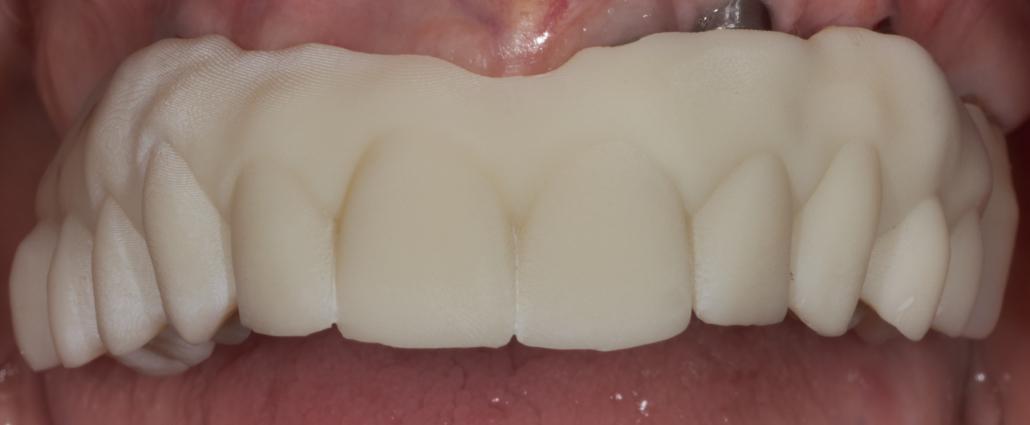 Provino stampato con dettagli anatomici