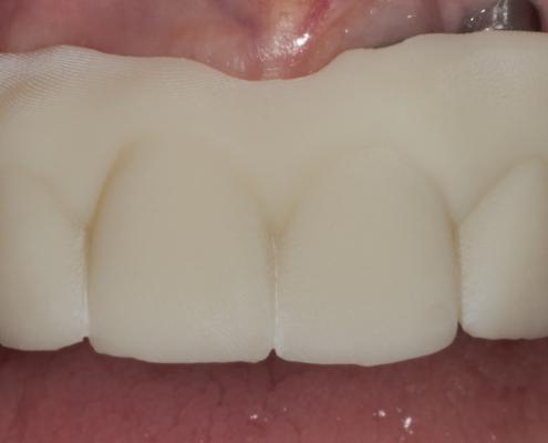 Provino stampato con dettagli anatomici