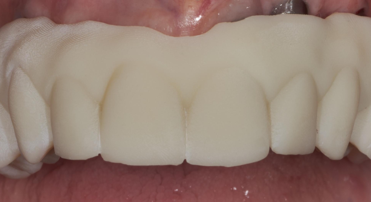 Provino stampato con dettagli anatomici