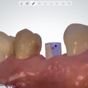 Librerie Implantari Librerie Implantari