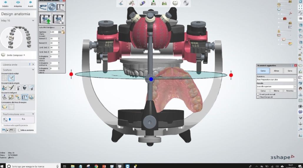 Arco facciale e articolatore analogici