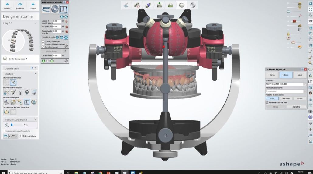 Arco facciale e articolatore analogici