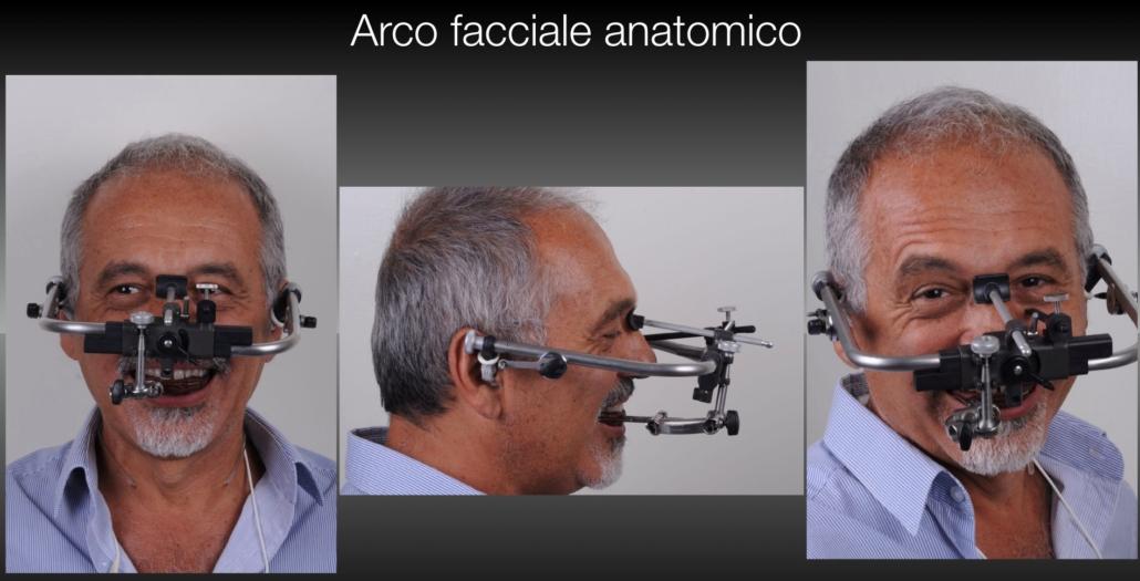 Arco facciale e articolatore analogici