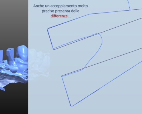 Scanbody ed impronte digitali - Affidabilità nella routine