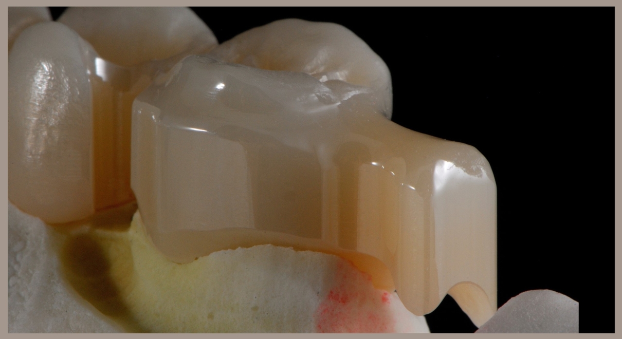 Attacchi individuali digitali