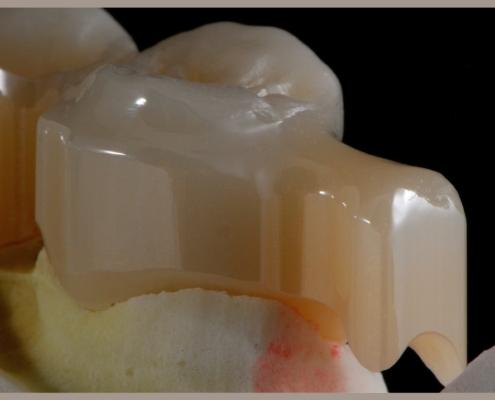 Attacchi individuali digitali