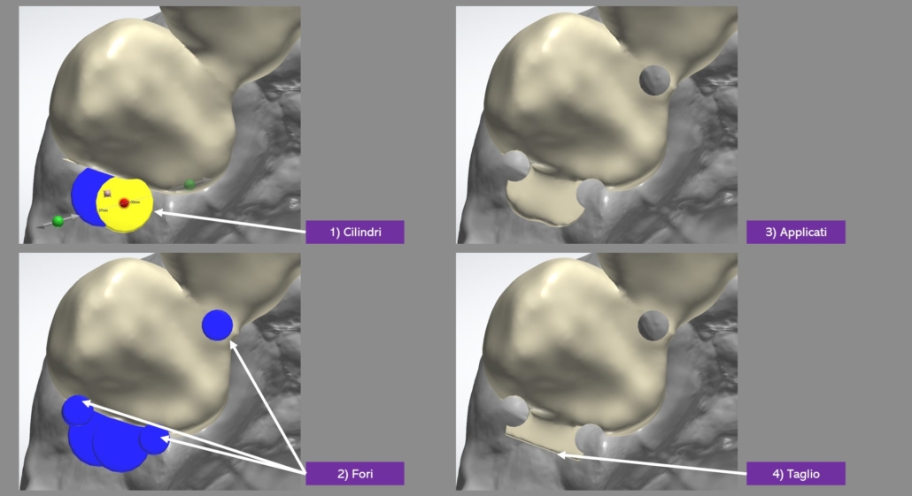 Attacchi individuali digitali