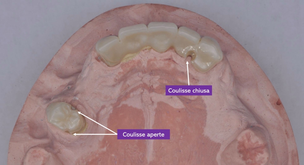 Attacchi individuali digitali