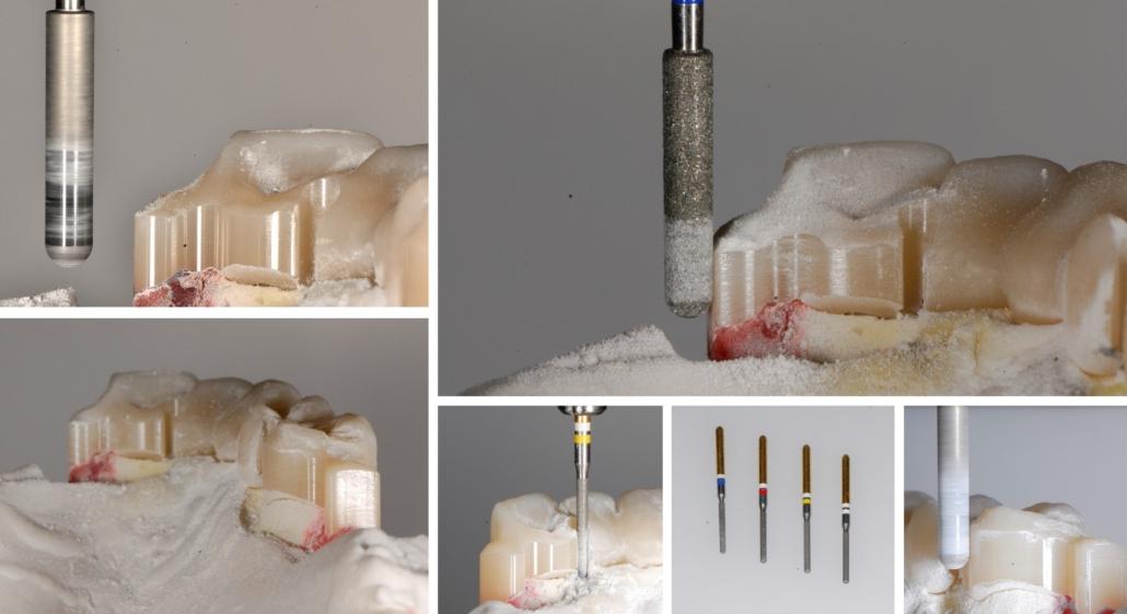 Attacchi individuali digitali