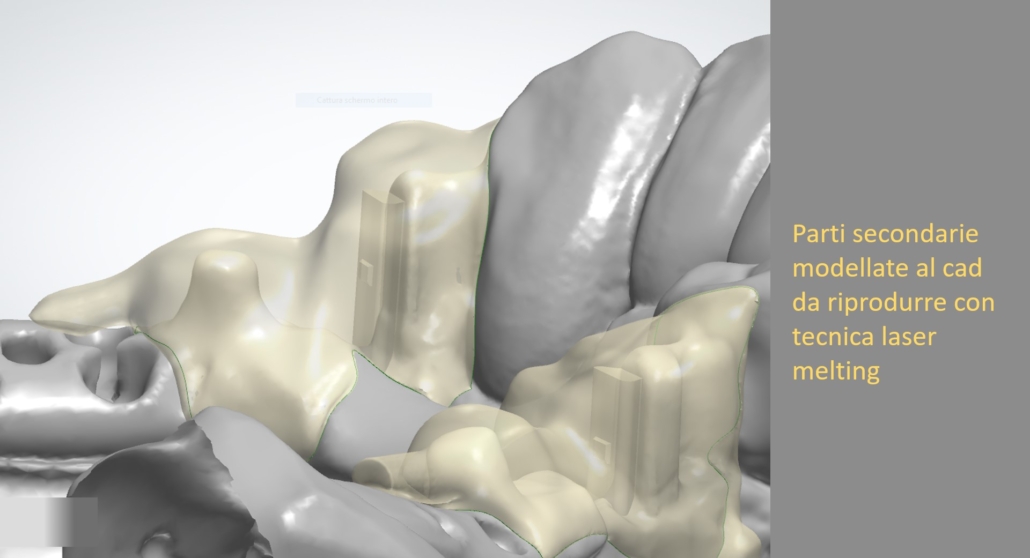 Attacchi individuali digitali