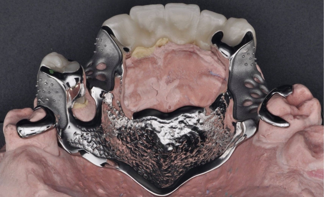 Attacchi individuali digitali
